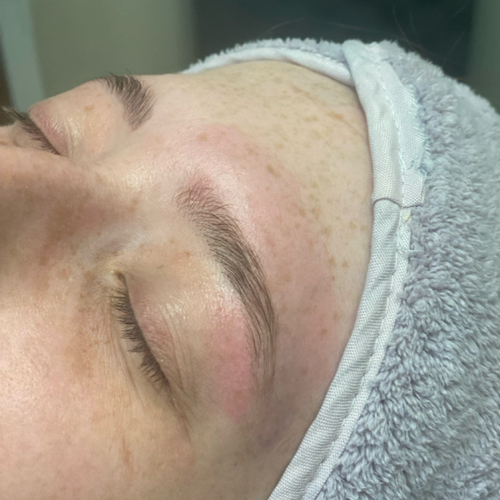 image processing20250328-79-gnwlyk